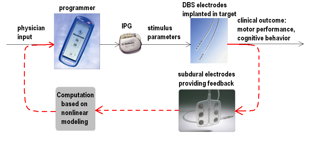 closed-loop DBS schematic